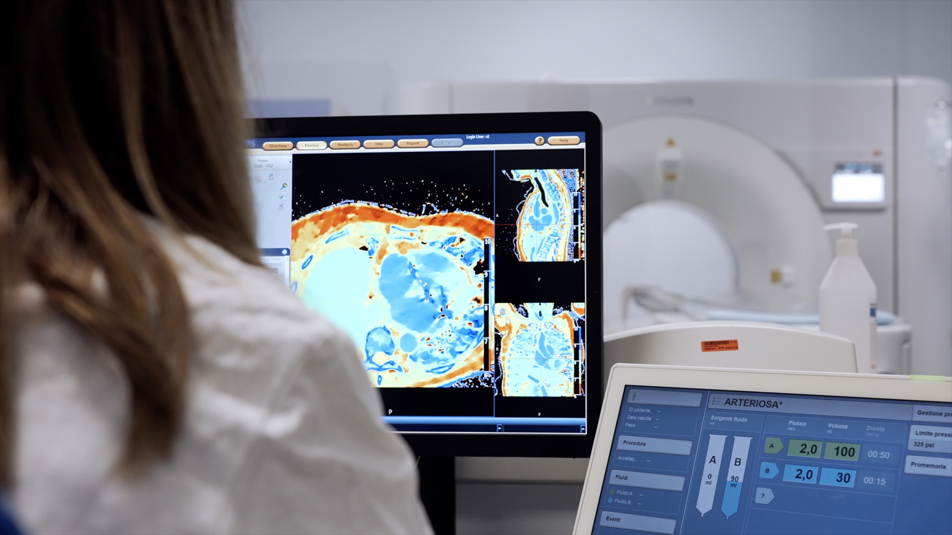 Foto di un medico che imposta una scansione sul gantry dello scanner TC, con il paziente sul lettino paziente del sistema TC