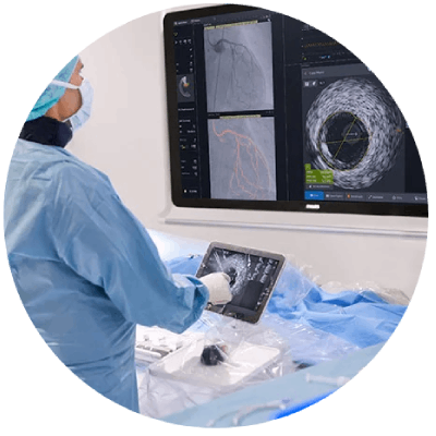 Medico che esegue una valutazione 2D del cuore con EPIQ CVXi