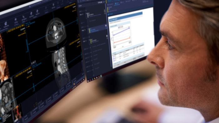 Informatica applicata alla radiologia