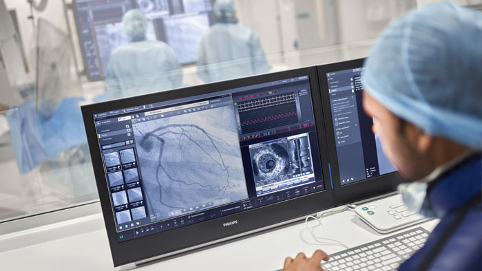 Intervento coronarico percutaneo