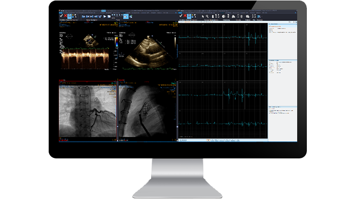 Schermata dell'interfaccia del modulo di cardiologia su un monitor