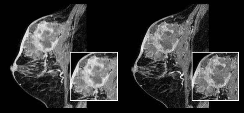 Risoluzione di scansione migliorata