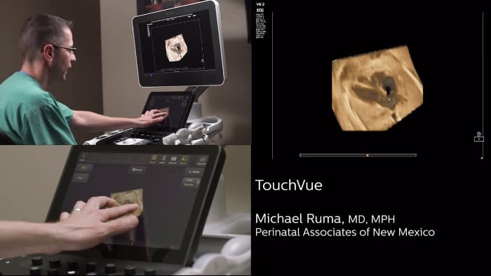 Dimostrazione di MPR Touch