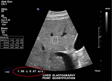 un primo piano di un'ecografia
