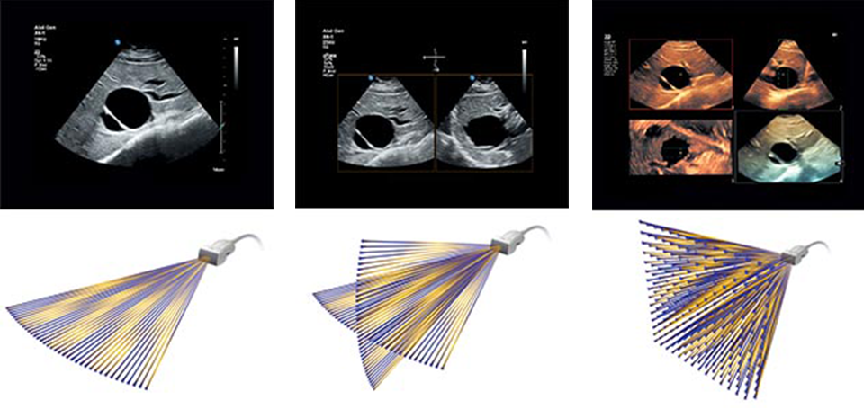 un collage di immagini ecografiche