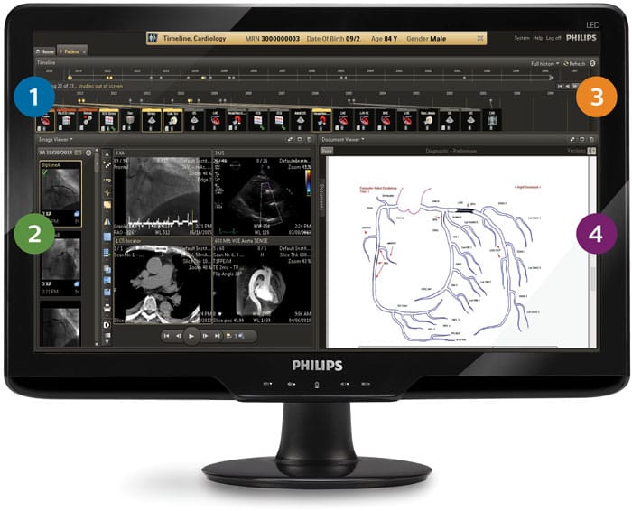 il monitor di un computer con uno screenshot di una scansione cardiaca