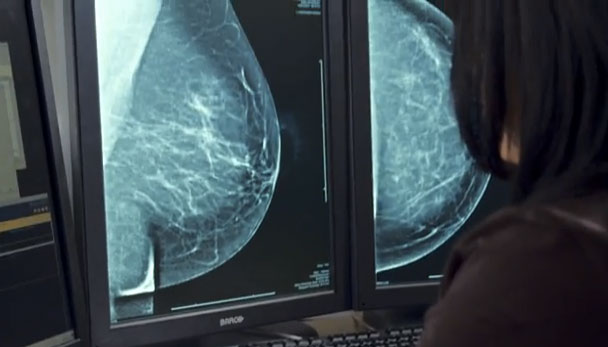 Semplificare la revisione delle immagini